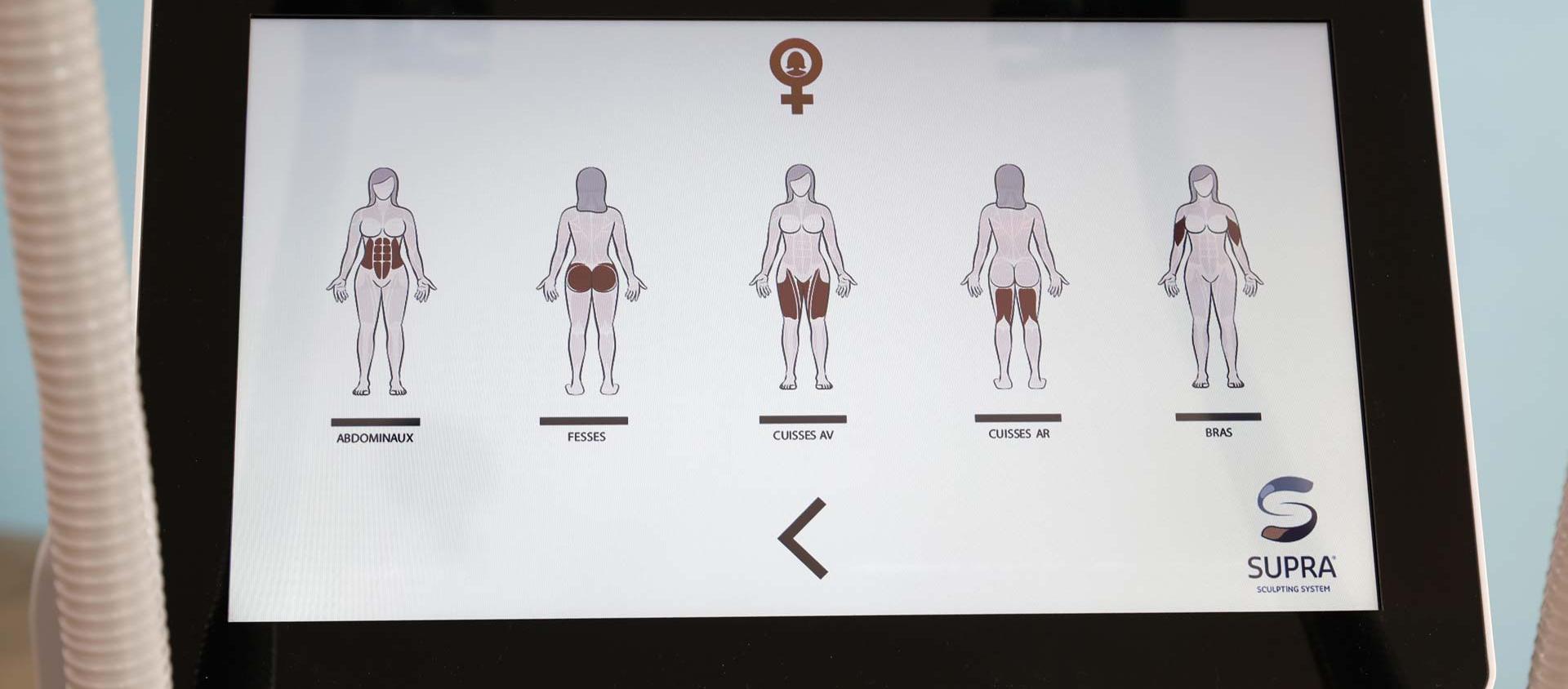 Photo de l'écran de la Supra (choix de la zone de traitement femmes)