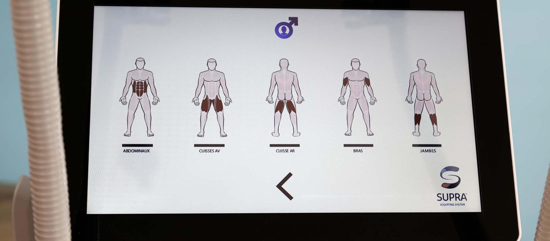 Photo de l'écran de la Supra (choix de la zone de traitement hommes)